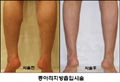 [NSP PHOTO]지방흡입 안 되는 부위가 어딨니?