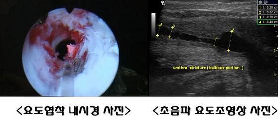 NSP통신-요됴협착 사진