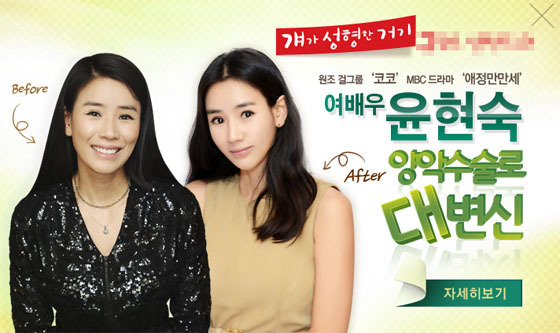 [NSP PHOTO]윤현숙, 양악수술 반전 미모 화제 헉! 누구...?