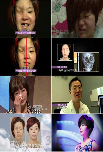 [NSP PHOTO]렛미인, 반쪽 얼굴 표가희의 기적적 페이스 오프 경악 그리고 감동