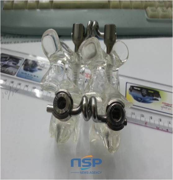 NSP통신-모형 척추 스크루 사진.