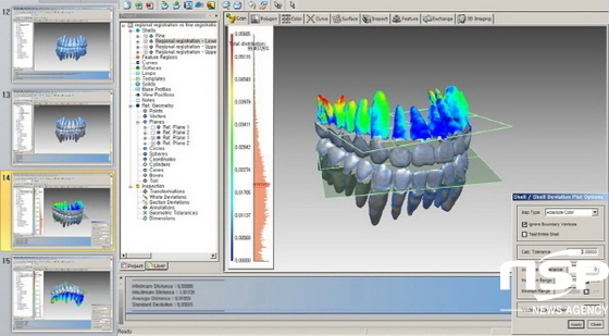 NSP통신-전남대 황현식 교수팀이 출원한 3차원 치아영상 획득 방법 화면. (전남대)