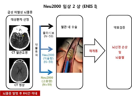 NSP통신-뇌졸중치료제 Neu2000의 임상2상 과정