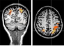 [NSP PHOTO]한국뇌연구원 정수근 박사팀 운전하는 뇌, 후두정엽에 비밀 있다