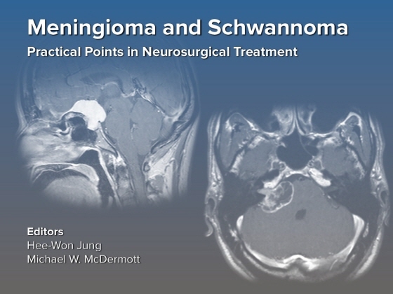 NSP통신-뇌수막종 및 신경초종의 수술적 치료 Active e-book의 표지 이미지. (분당서울대병원)