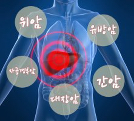 [NSP PHOTO]안성시, 휴가철 암 검진 꼭 받으세요