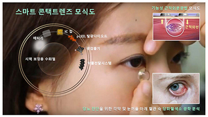 [NSP PHOTO]콘택트렌즈로 당뇨진단…스마트 헬스케어 렌즈 본격 상용화