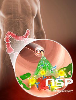 NSP통신-스프레이 방식 형광 프로브의 대장암 진단 (POSTECH)
