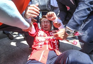 [NSP PHOTO]자유한국당 권영진 대구시장 후보, 공식 선거운동 첫날 폭행 당해…전치 3주 부상
