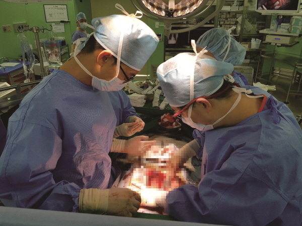 NSP통신-계명대 동산병원 의료진이 심장이식 수술을 하고 있는 모습. (계명대학교 동산병원)