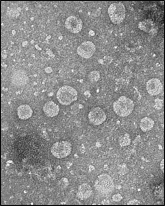 NSP통신-전자현미경으로 촬영(Bio-TEM)한 녹차유산균 엑소솜(L. plantarum exosome). (아모레퍼시픽)