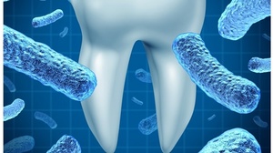 [NSP NEWS Image]들어보니 잇몸 질환과 암의 연관성은