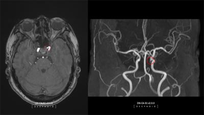 [NSP PHOTO]딥노이드, 뇌동맥류 뇌영상검출·진단보조소프트웨어 딥뉴로 혁신의료기술 선정