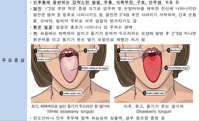 NSP통신-성홍열 주요 증상 안내문. (이미지 = 오산시)