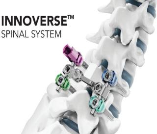 NSP통신-시지메드텍의 척추 고정 장치 이노버스 스파이널 시스템(INNOVERSE Spinal System) (이미지 = 대웅제약)
