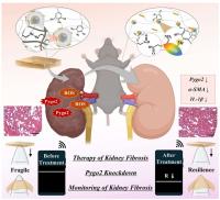 [NSP PHOTO]원광대 진은정 교수 연구팀, 신장 섬유화 차세대 유전자 치료 전략 개발